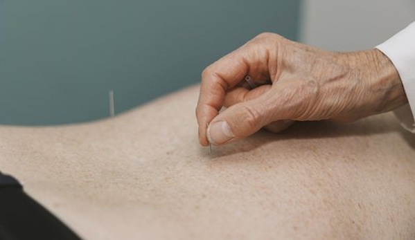 Carter Chiropractic & Dubbo Acupuncture - Dubbo, NSW