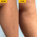 Metro Vein Centers | Buffalo - Medical Clinics
