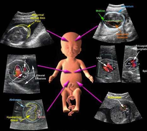 Heavenly 3d 4d Ultrasounds - Baldwin Park, CA