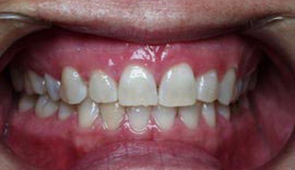 The Smile Office - Balgowlah, NSW