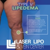 St Louis Laser Vein Center gallery