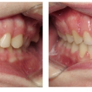 MI Smile Journey by Thomas Orthodontics - Saginaw - Orthodontists