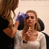 Denver Botox: GATTONI Medical Aesthetics gallery