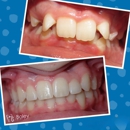 Boley Braces - Orthodontists