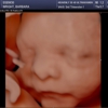 Heavenly 3D 4D Ultrasounds-Upland gallery