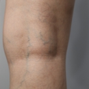 Loop Medical Center: Pain Management and Varicose Vein Doctor in Chicago - Medical Centers