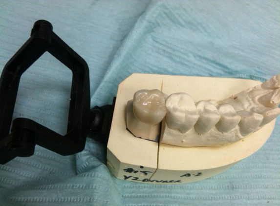 Precision Dental Ceramics Laboratory - Houston, TX