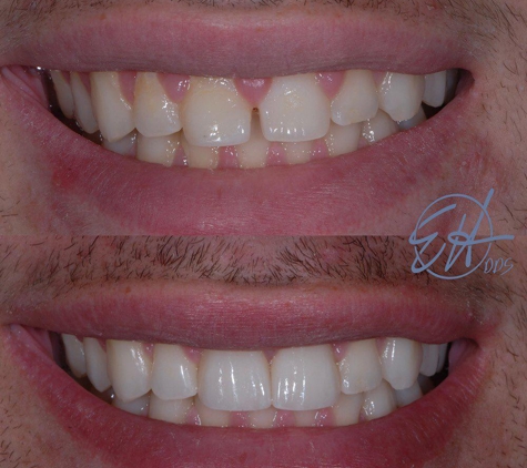 Eric Hull DDS Aesthetic & General Dentistry - Comstock Park, MI