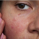 Daniel S. Ring, MD - Physicians & Surgeons, Dermatology