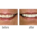 Jurich Dental - Family Cosmetic and Sedation Dentistry - Cosmetic Dentistry