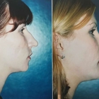 Royce Plastic Surgery