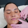 LaserAway Orlando gallery