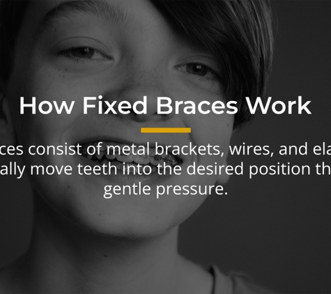 Moonah Dental Centre – Hobart CBD. How Fixed Braces Work