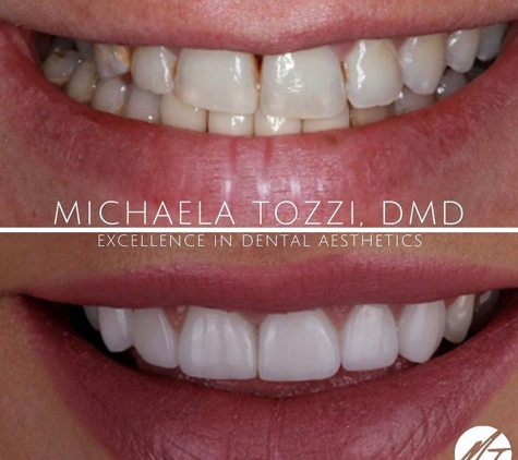 Dr. Michaela Tozzi, DMD: Cosmetic Dentistry & Dental Aesthetics - Henderson, NV