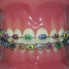 Johnson Orthodontics gallery