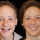 Birmingham Dental Implant Studio - Implant Dentistry