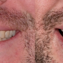 Hoopes Dental - Dental Hygienists