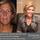 Synergy MedAesthetics - Kennewick