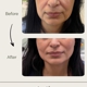 Permaskin Med Spa & Laser