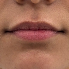 Novae Medical Aesthetics