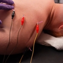 Resurgence Rehab & Performance - Physical Therapy Clinics