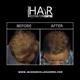 Jacksonville Hair Restoration Center