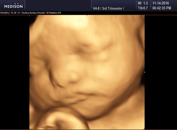 Heavenly 3d 4d Ultrasounds - Baldwin Park, CA