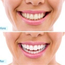 Carolina Coast Family Dentistry - Implant Dentistry