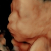 A New Conception 4D Ultrasound Studio gallery