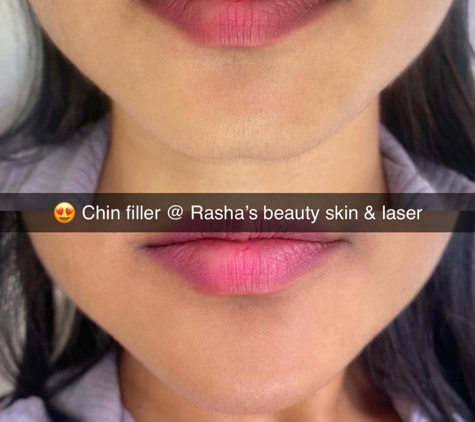 Rasha's Beauty Skin & Laser - Salem, MA