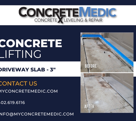 ConcreteMedic - Omaha, NE. ConcreteMedic - Concrete Driveway lift in Omaha, NE, using Polyurethane Mudjacking method.