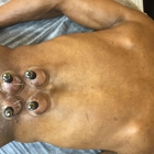 Acupuncture Pain and Stress Center