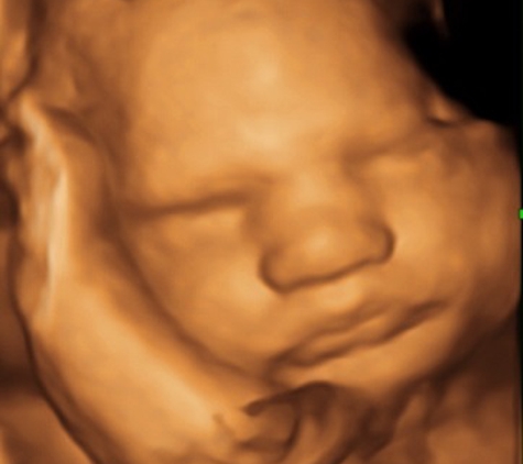 A New Conception 3D Ultrasound Studio - Hanover, MA. 30 weeks baby in 3D Ultrasound