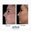 Athre Facial Plastics: Dr Raghu Athre gallery