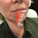 Botox Anonymous - Medical Spas