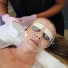 LaserAway Washington DC Logan Circle
