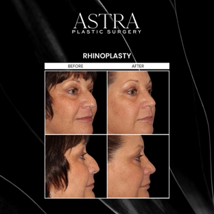 Astra Plastic Surgery - Atlanta - Atlanta, GA