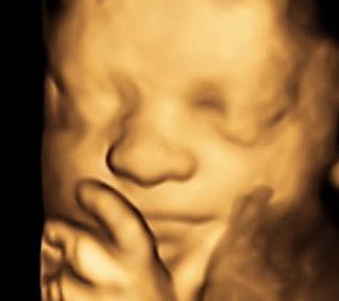 Bundle of Love 3D/4D 5D HDLive Ultrasound & Baby Boutique - Gastonia, NC. 3D picture of 28 week baby