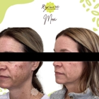 Refine MD