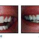 Wyse Family & Cosmetic Dentistry - Teeth Whitening Products & Services