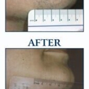 Idaho Dermatologic Surgery & Laser Center - Beauty Salons