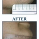 Idaho Dermatologic Surgery & Laser Center