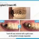 K Family Dentistry General Cosmetic Emergency Implants - Cosmetic Dentistry