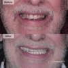 Michigan Dental Implant Studio gallery