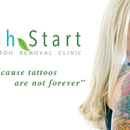 Fresh Start Laser Clinic - Tattoo Removal