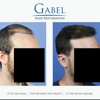 Dr. Steven Gabel, MD, FACS gallery