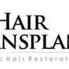 My Hair Transplant MD gallery