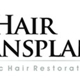 My Hair Transplant MD