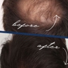 The Hair Loss Doctors gallery