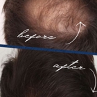 The Hair Loss Doctors By Robert J. Dorin